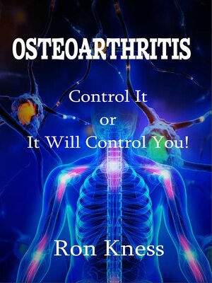 cover image of Osteoarthritis